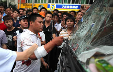 与深圳城管冲突受伤 小贩拳击执法车